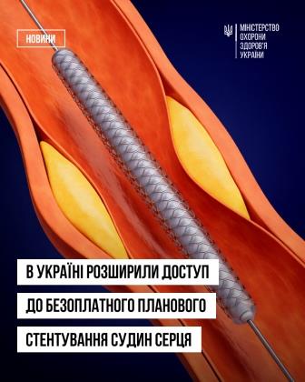 В Україні розширили доступ до безоплатного планового стентування судин серця